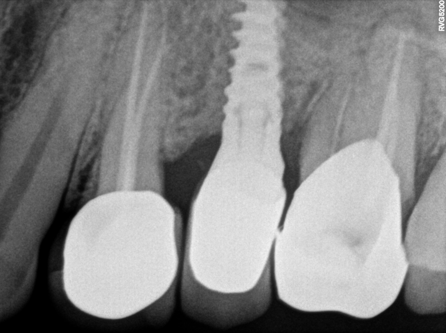 Dental X-ray